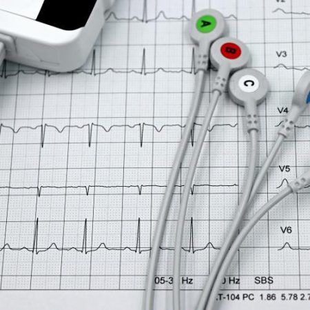 Comisia Europeană cere feedback pentru screening cardiovascular invocând 1,7 milioane de decese anual în UE em360
