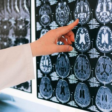 Comisia Europeană pune cercetarea cancerului cerebral în centrul luptei împotriva cancerului em360