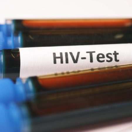 Niciuna dintre cele 12 clinici auditate de ECDC în România, Grecia și Polonia nu a atins ținta de confirmare HIV în cinci zile em360